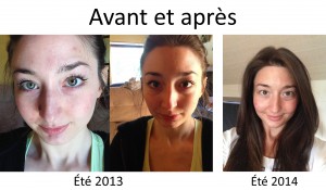 before after